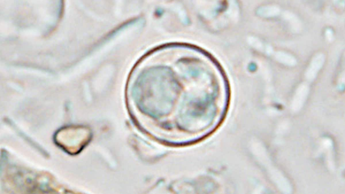 Magnified image of a parasite inside circular shell