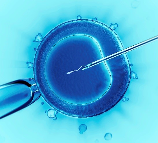 Image of Intracytoplasmic sperm injection (ICSI) technique used during in vitro fertilization (IVF)