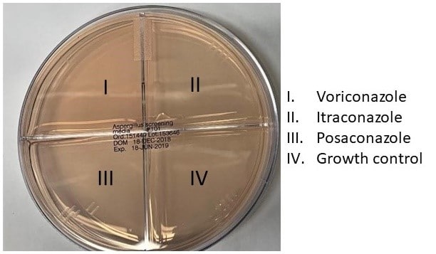 Aspergillus screening plate with reagent assignments in each well