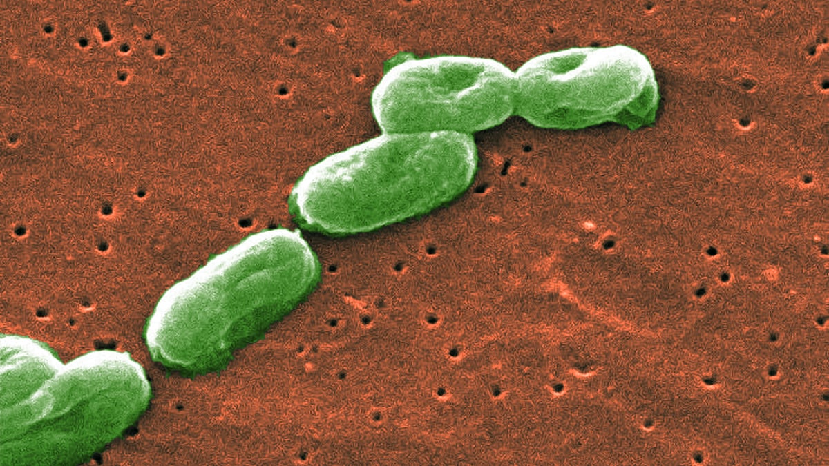 Electron Micrograph of Burkholderia cepacia