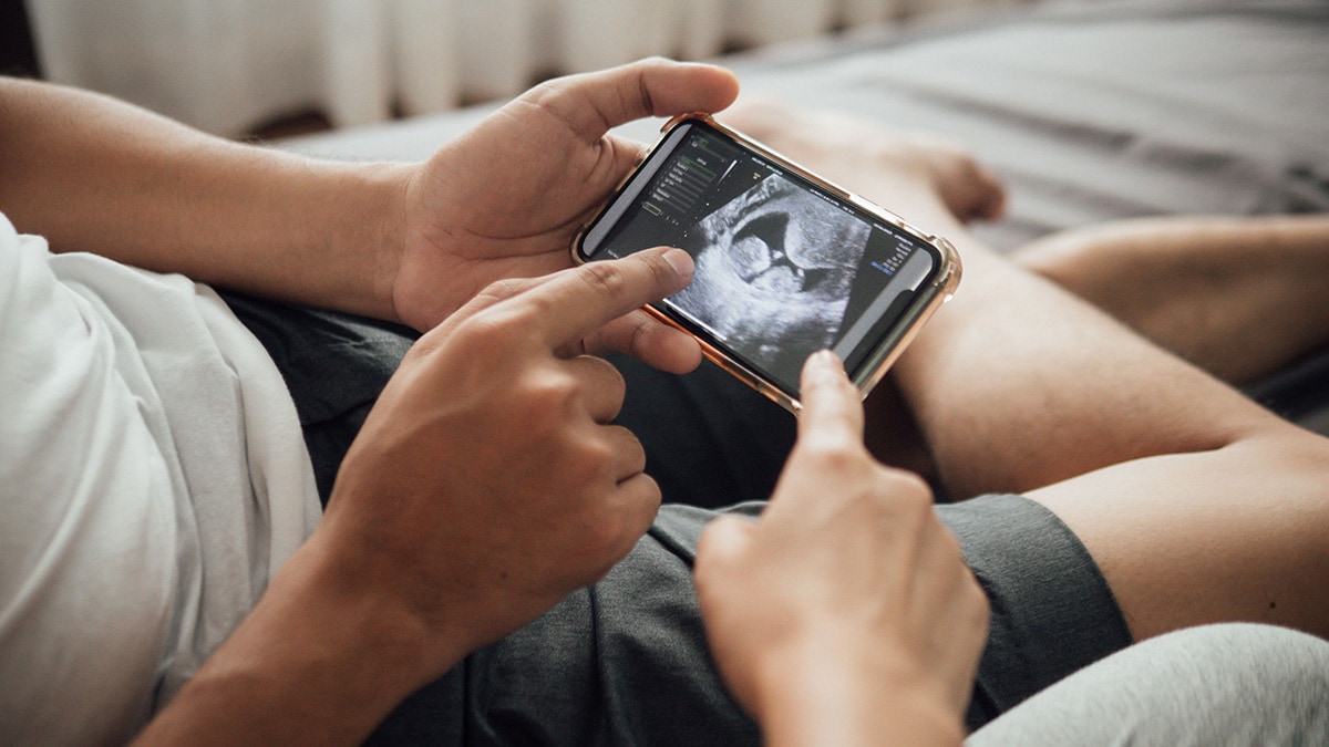 Two sets of hands holding an ultrasound photo of a baby