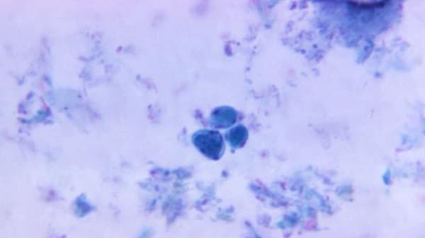 Blastocystis hominis protozoan cysts