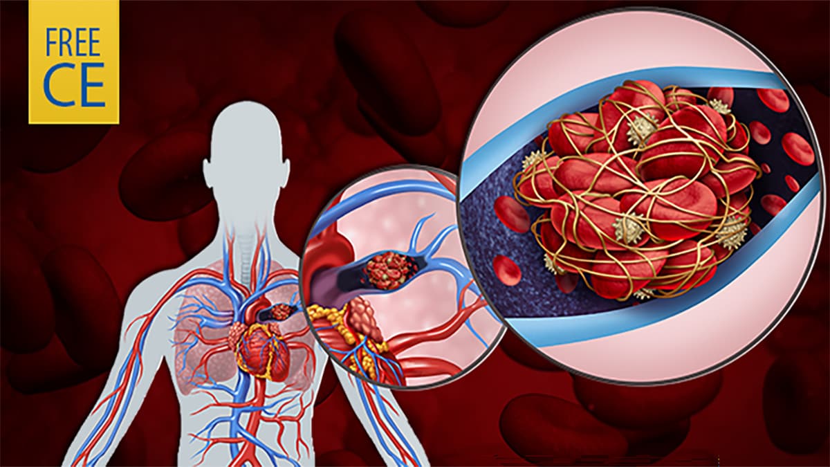 Blood clot training