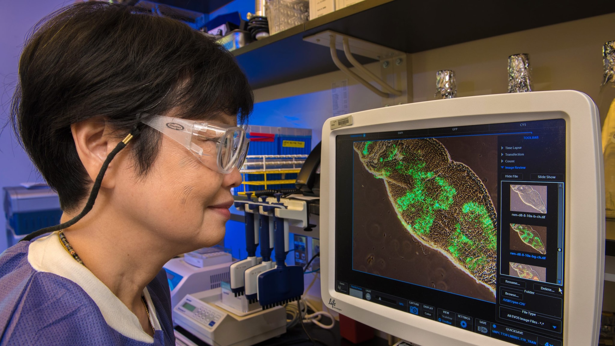 Scientist analyzing an image of a virus on a computer.