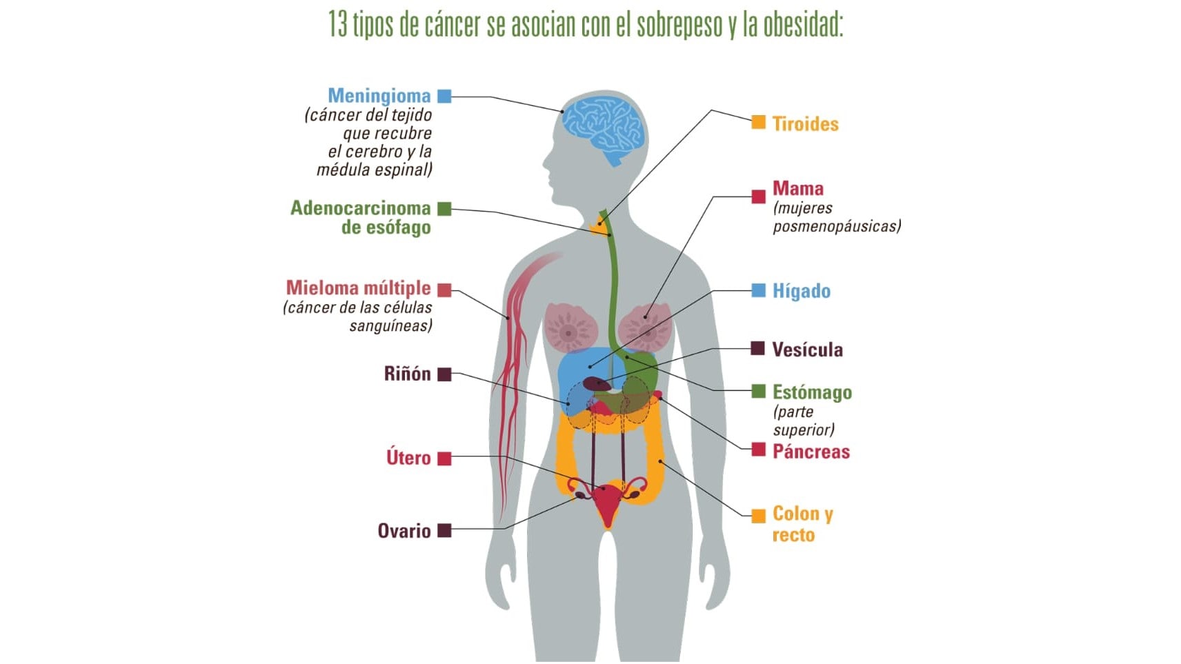 13 tipos de cáncer se asocian con el sobrepeso y la obesidad: meningioma (cáncer del tejido que recubre el cerebro y la médula espinal); adenocarcinoma de esófago Mieloma múltiple (cáncer de las células sanguíneas); riñón; útero; ovario; tiroides; mama (mujeres posmenopáusicas); hígado; vesícula; estómago (parte superior); páncreas; y colon y recto.