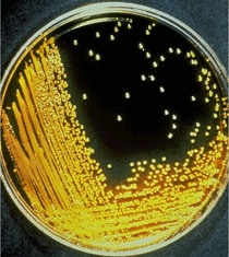 Vibrio cholerae colonies growing on thiosulfate-citrate-bile salts-sucrose (TCBS) agar plate.