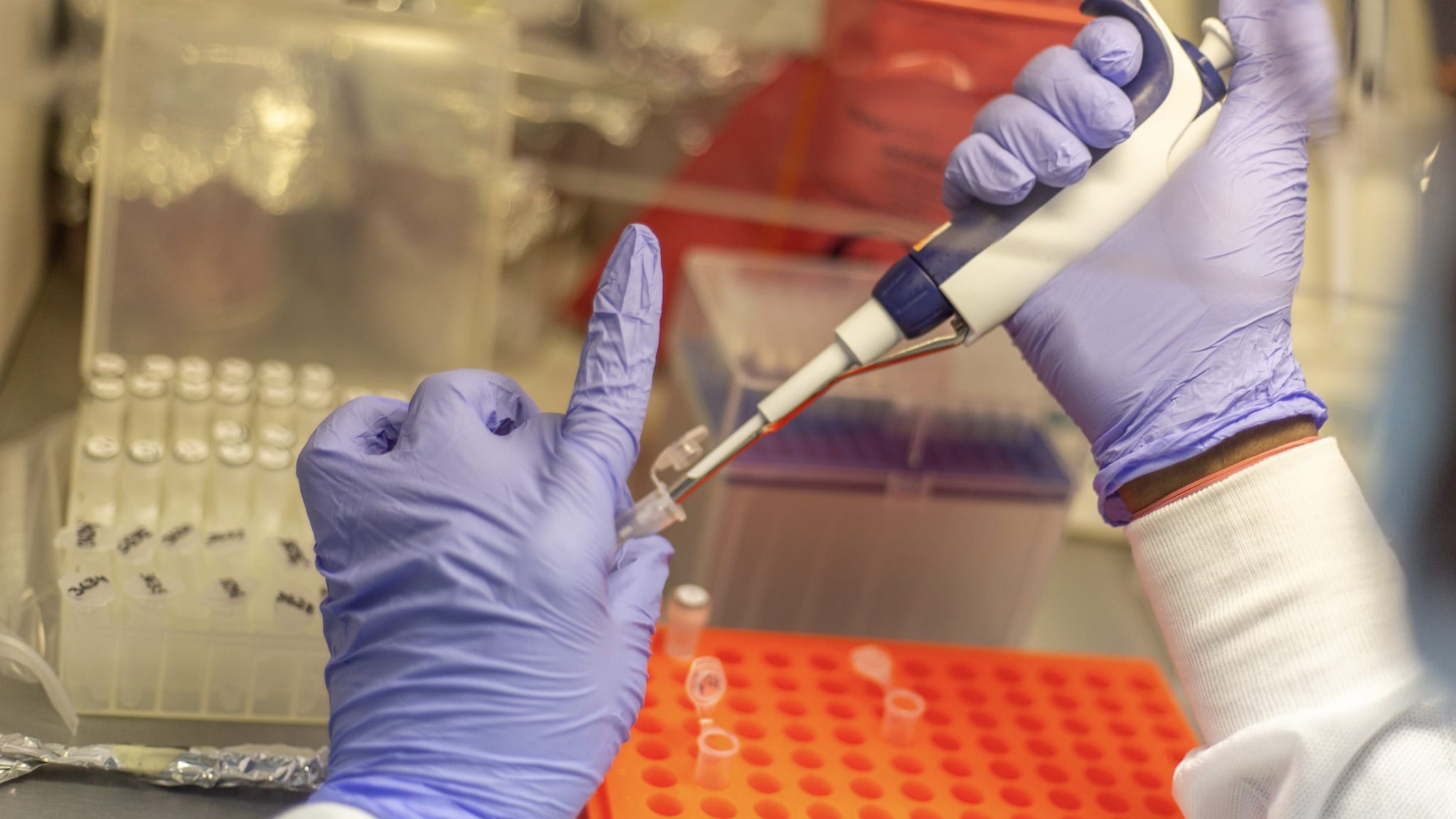 Lab staffer with cholera samples