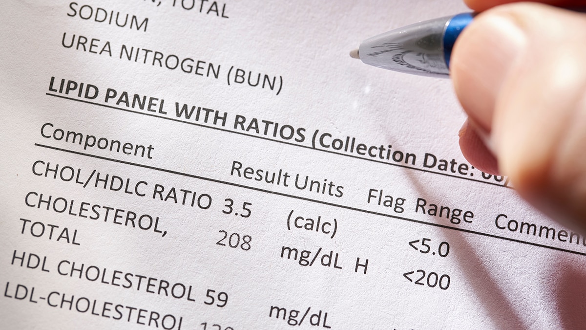 Cholesterol lab report.