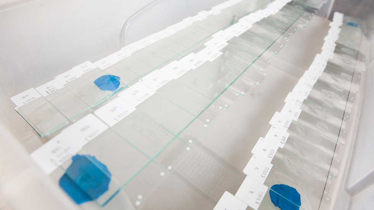 Slides prepared with tissue samples for immunohistochemistry assay in the laboratory.