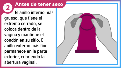 Un par de manos sosteniendo un condón femenino desde el anillo grueso, interno.