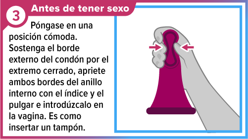 Una mano apretando el anillo grueso interno del condón femenino preparándolo para ser insertarlo.