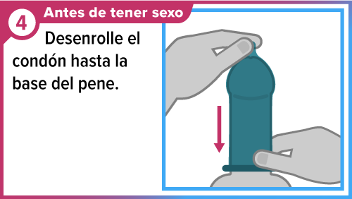 Mano desenrollando un condón a lo largo del pene.