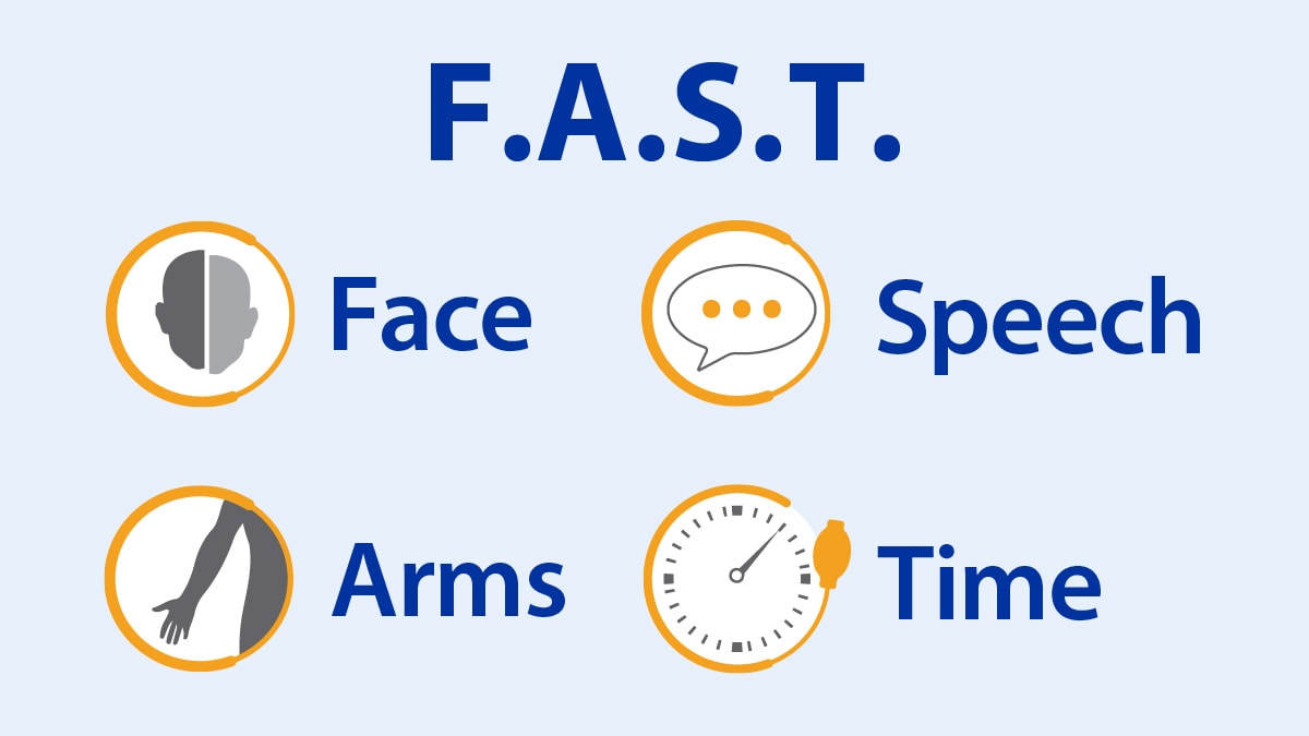 F.A.S.T.—Face, Arms, Speech, Time