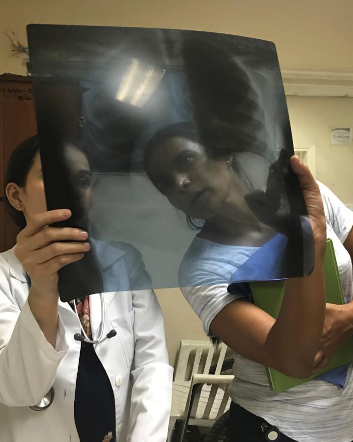 doctors examine an X-ray of a dengue patient