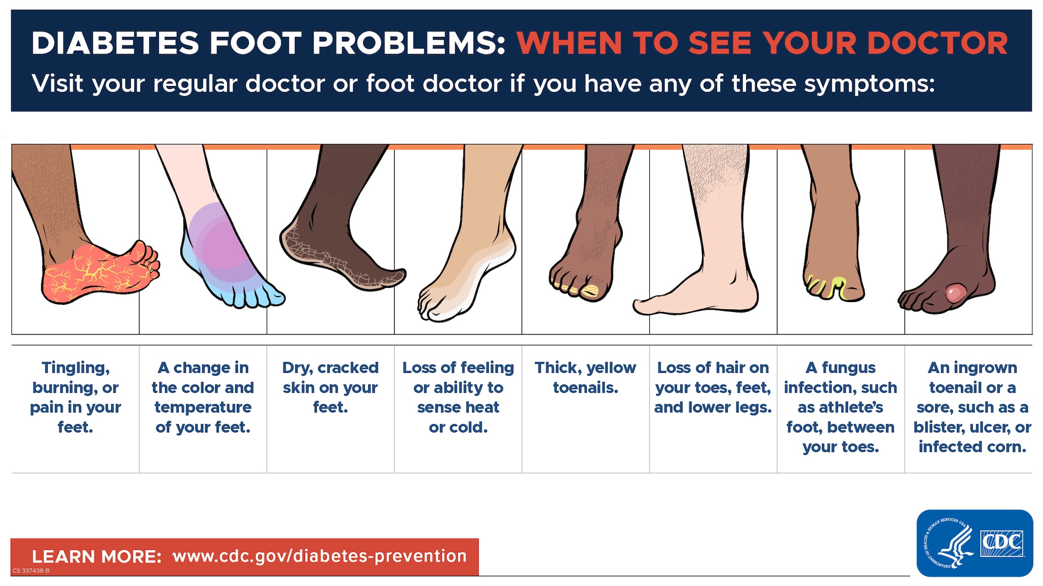 Diabetes Foot Problems - Visit your regular doctor or foot doctor if you have any of these symptoms.