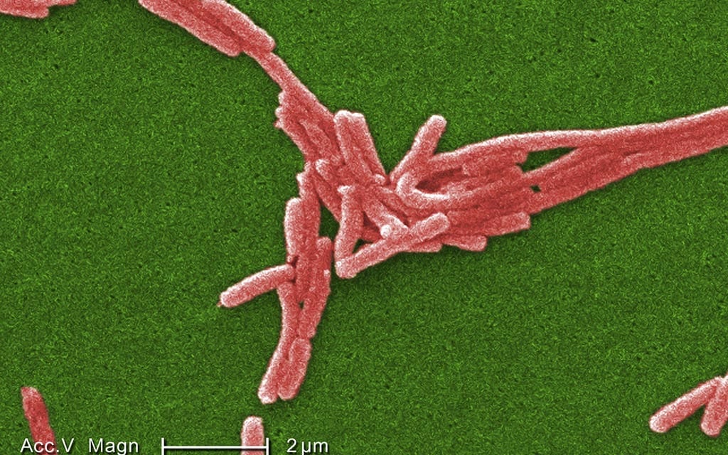 This shows a <em>Legionella pneumophila</em> (Legionnaires' disease) bacterium as seen through a scanning electron micrograph (SEM). Scientists digitally added color to this image so that the bacteria would be seen more clearly.