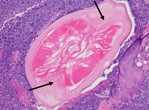 Case_511_C_answer