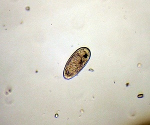 Philophthalmiasis image