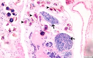 Philophthalmiasis image