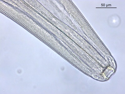 Figure B: Anterior of Thelazia callipaeda showing wide, moderate depth, buccal cavity and prominent tightly spaced cuticular striations.