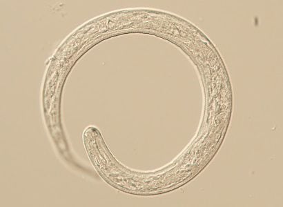 Figure A: L1 larva of Thelazia sp., likely T. callipaeda based on the patient’s travel history. L1 larvae measure up to 400 µm long and 13.5 µm wide. While not visible on this specimen, normally larvae are passed encased in a shell membrane.