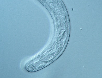 Figure B: Anterior end of the larva. Note the lack of buccal cavity, and the developing cuticular striations.