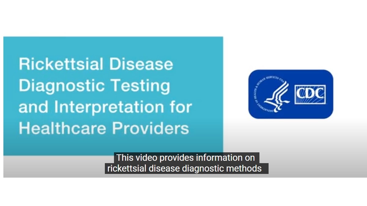 Rickettsial Disease Diagnostic Testing and Interpretation for Healthcare Providers.