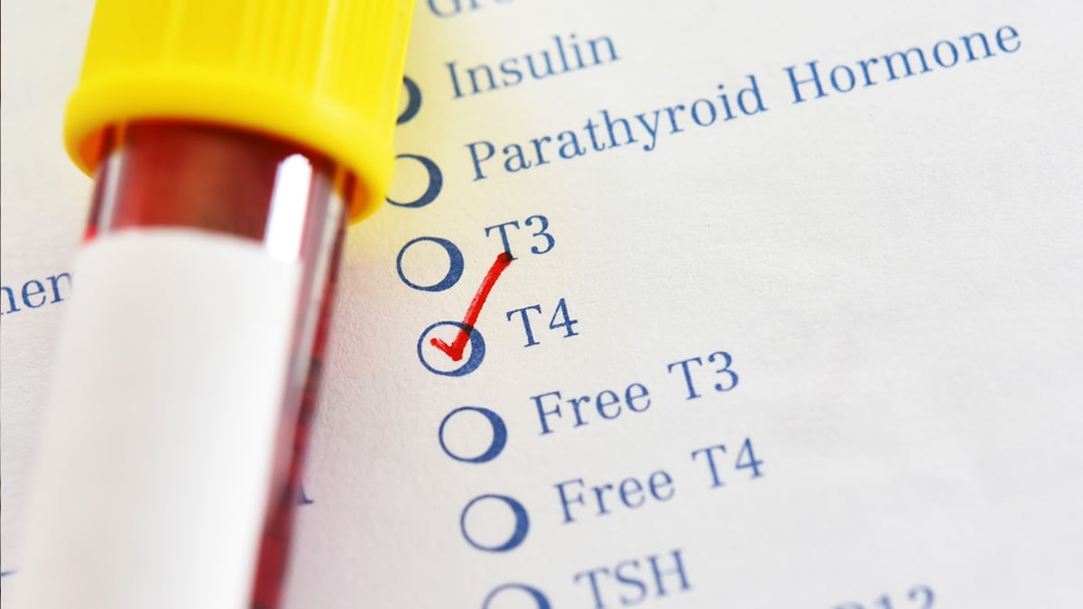 Sample vial on top of hormone disorder checklist with "T4" checked