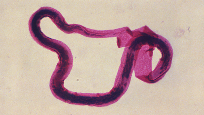 Ultrastructural detail of Brugia malay, one of the cuases of LF