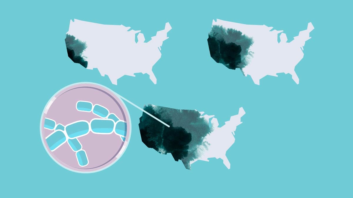 maps of U.S. showing expanding range of coccidioidomycoses