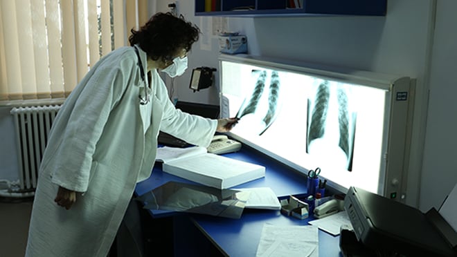 Clinician looks at chest X-rays.