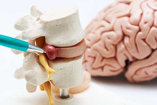 Pen pointing to model of backbones with herniated disc Brain model in background