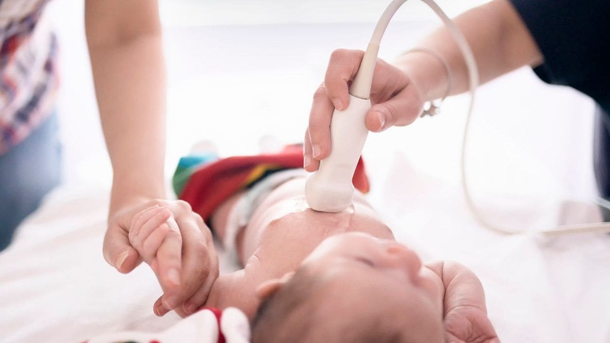 An infant receiving an echocardiogram to check his heart