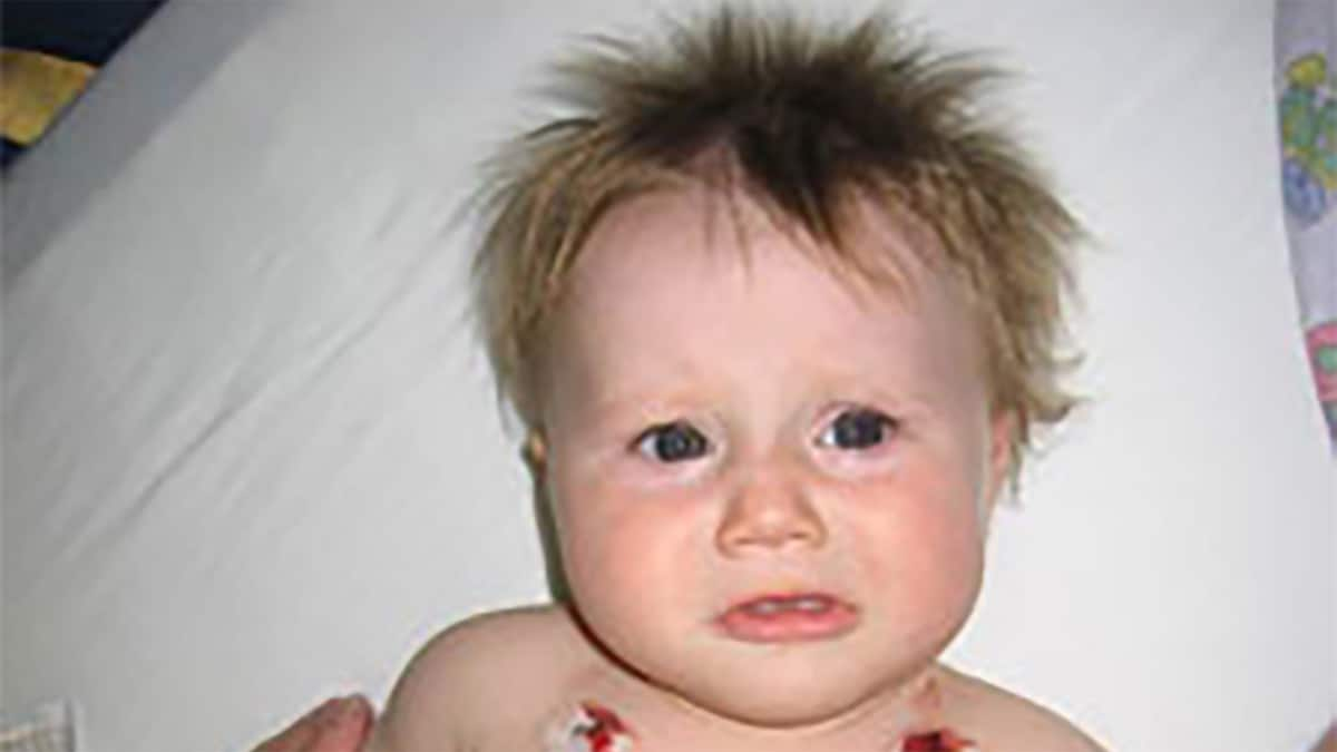 Male infant laying on a mattress receiving treatment through tubes attached to his chest