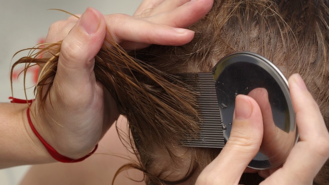 Child being treated for head lice with a nit comb.