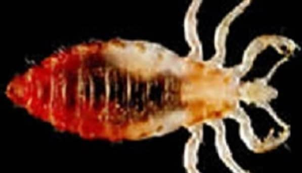 body lice