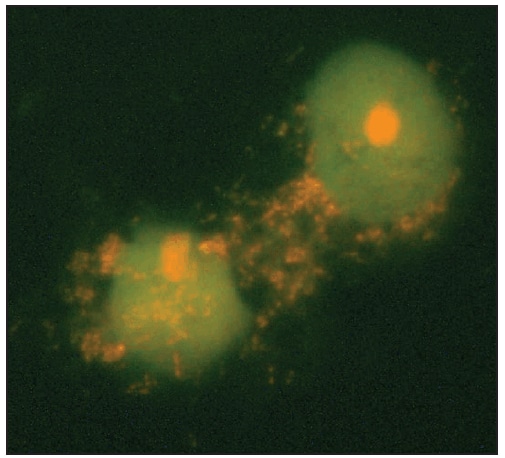 This figure is a photograph showing an acridine orange stain of Rickettsia africae isolated in Vero E6 cells from an eschar biopsy specimen from a patient with African tick bite fever.