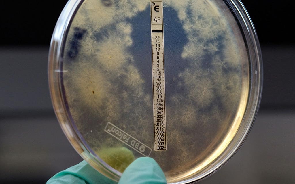 Someone holding a fungus specimen.