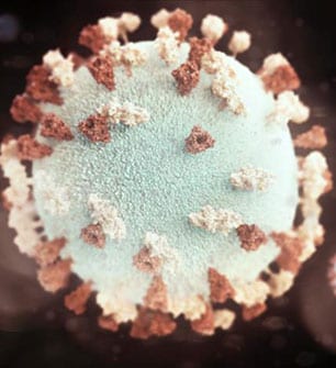 mumps virus