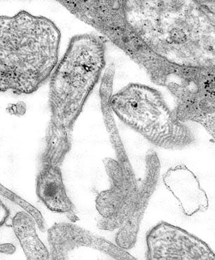 Thin sectioned transmission electron micrograph (TEM) depicting cell cultured mumps virions