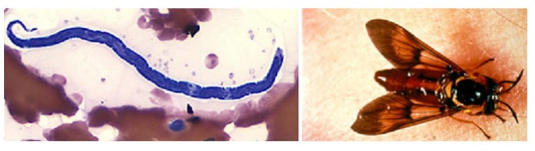 Two images of parasites. On the left microfilaria of L. loa is shown in a thin blood smear, stained with Giemsa. On the right is an image of Chrysops silacea deerfly feeding on a human hand.