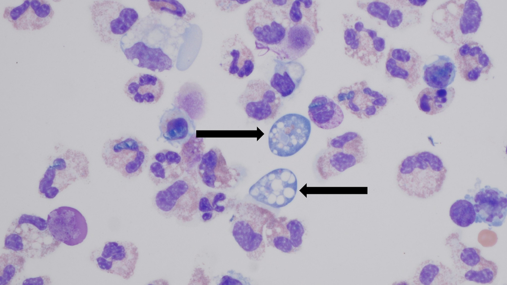 High resolution ofNaegleria fowleri ameba.