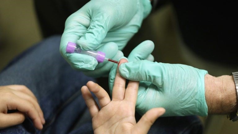 Child's finger giving blood through a finger prick.