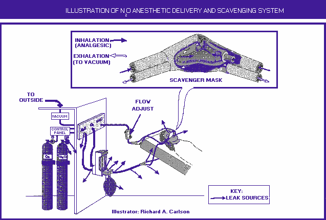 Illustration N2O anesthetic delivary and scavenging system.