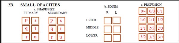 2B. Small Opaciites form sample