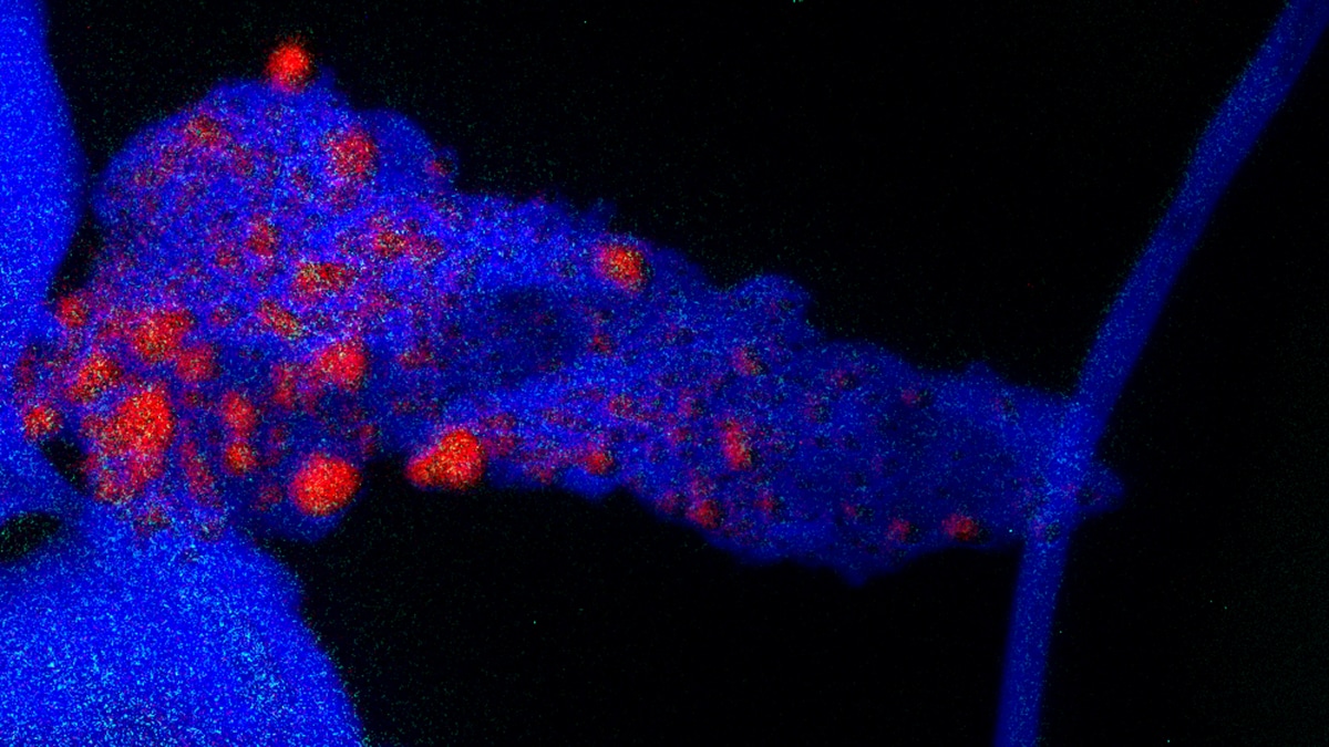 An EFTM image of the distribution nanoscale copper within cell structures of wood dust.