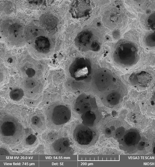 Image showing corrosion pits in metal ground support caused by galvanic corrosion between carbonaceous rock that electrochemically behaves similar to graphite.