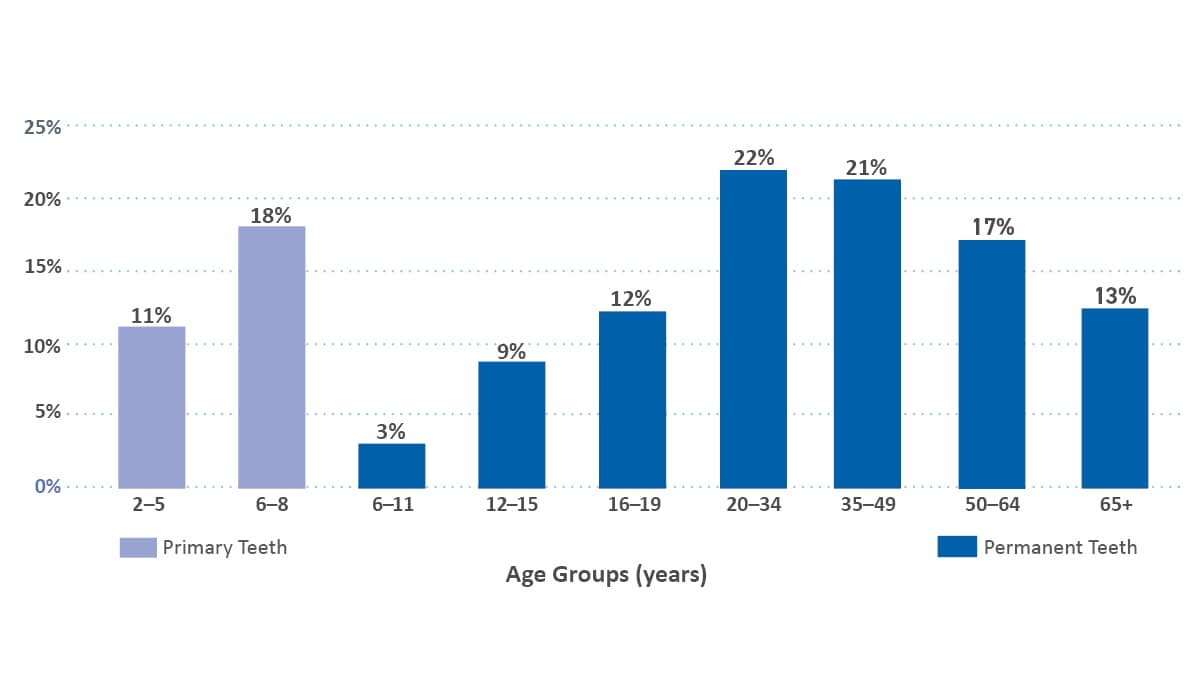 Bar graph showing the prevalence of untreated tooth decay in primary in light purple or permanent teeth in dark blue by age.