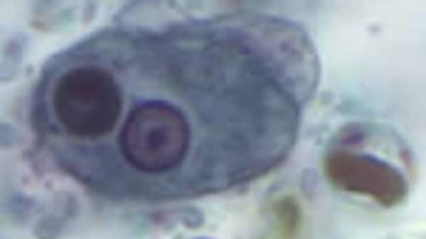 Protozoa