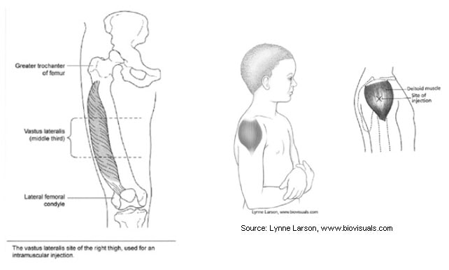 Image of vastus lateralis muscle and site of the upper and right thigh used for intramuscular injections in babies. Image of youth and close up of deltoid muscle site of injection. Source: Lynne Larson, www.biovisuals.com.